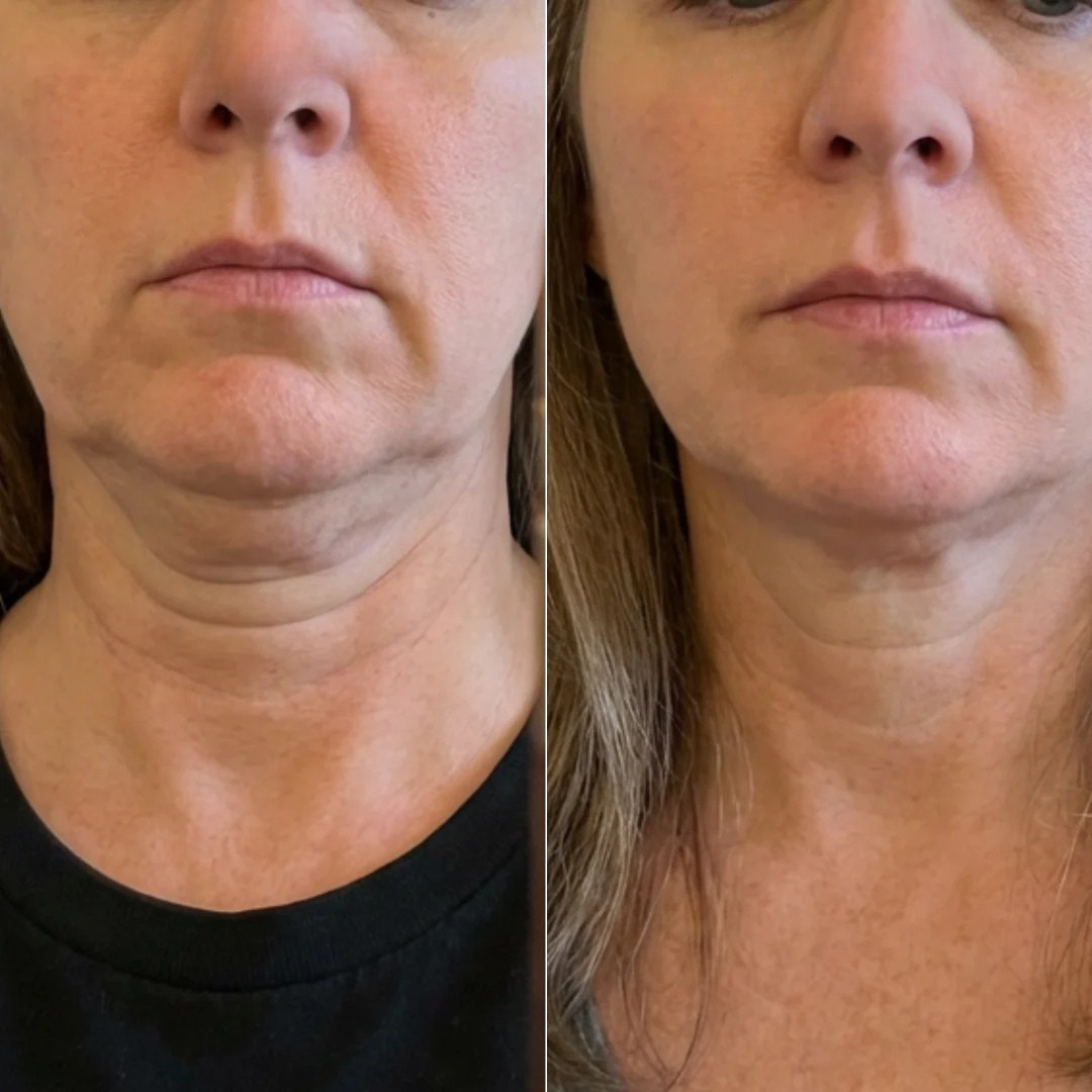 Testimonianza Caterina - prima e dopo