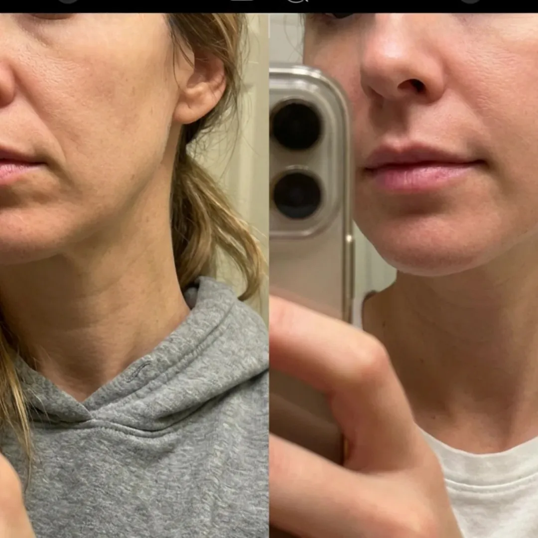 Testimonianza Rachele - prima e dopo