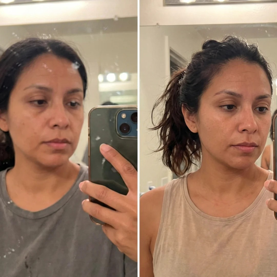 Testimonianza Laura - prima e dopo